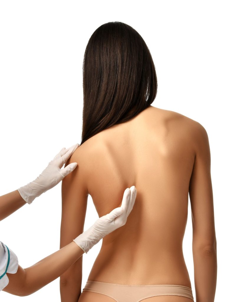 兒童脊柱側彎嚴重者終生要覆診