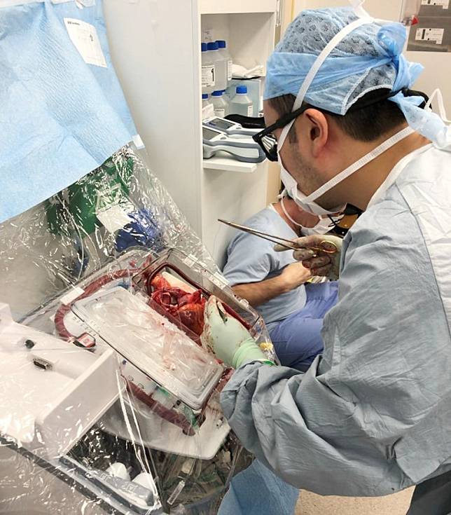 養心機透過系統接駁心臟泵血，讓心臟從捐贈者體內摘出後，保持溫暖與跳動，最長可保存心臟10小時