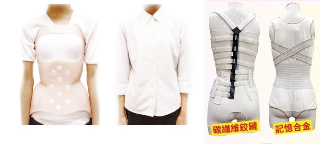 傳統矯形腰架比較笨重, 理大及港大團隊研發出2款較輕便及靈活的全新矯形架 ， 現正做臨床測試 ，期望4年內可以 推出市場。 