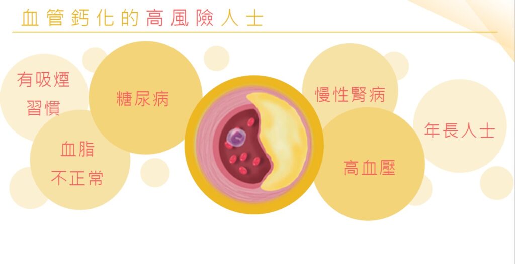 血管鈣化高風險人士