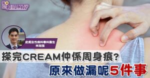 乾到裂？塗潤膚膏都未必有效！ 原來做漏了5 件事