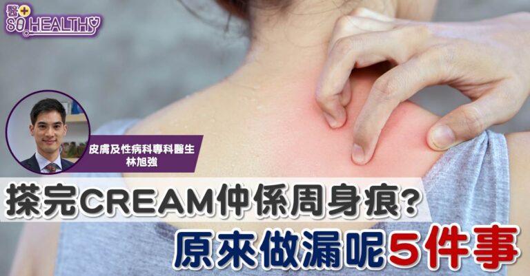 乾到裂？塗潤膚膏都未必有效！ 原來做漏了5 件事