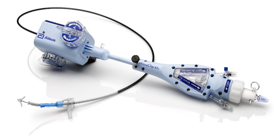 氣喘 / 胸痛 / 腳腫 一文睇清二尖瓣倒流