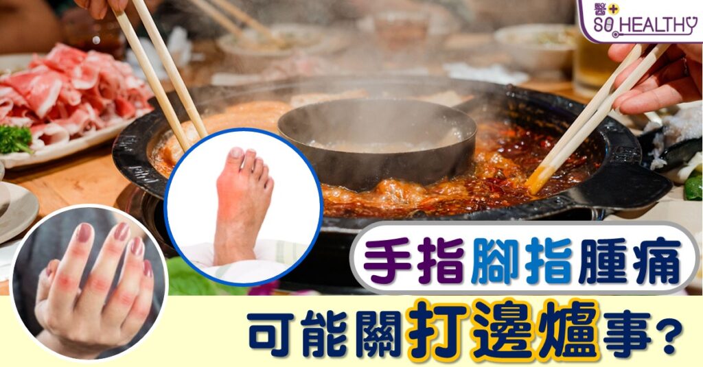 解構痛風成因 /位置 /飲食 與糖尿病、高血壓及腎衰竭4者息息相關