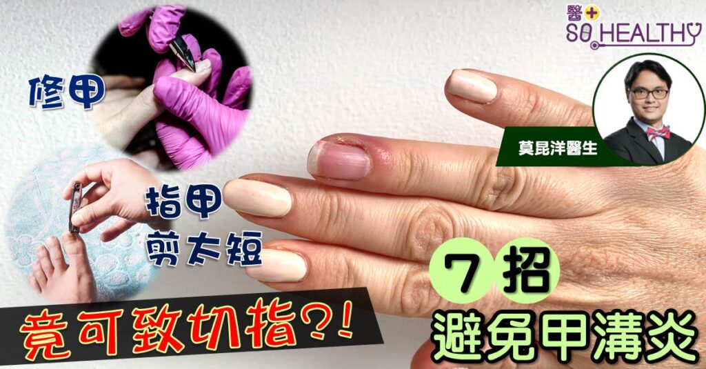 修甲搞到紅腫好平常？甲溝炎可大可小