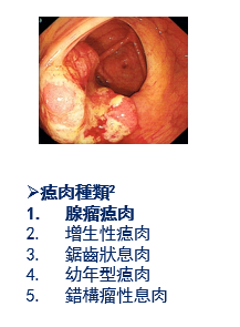 瘜肉可分為五大類，其中腺瘤瘜肉有癌變風險，可發展成大腸癌。