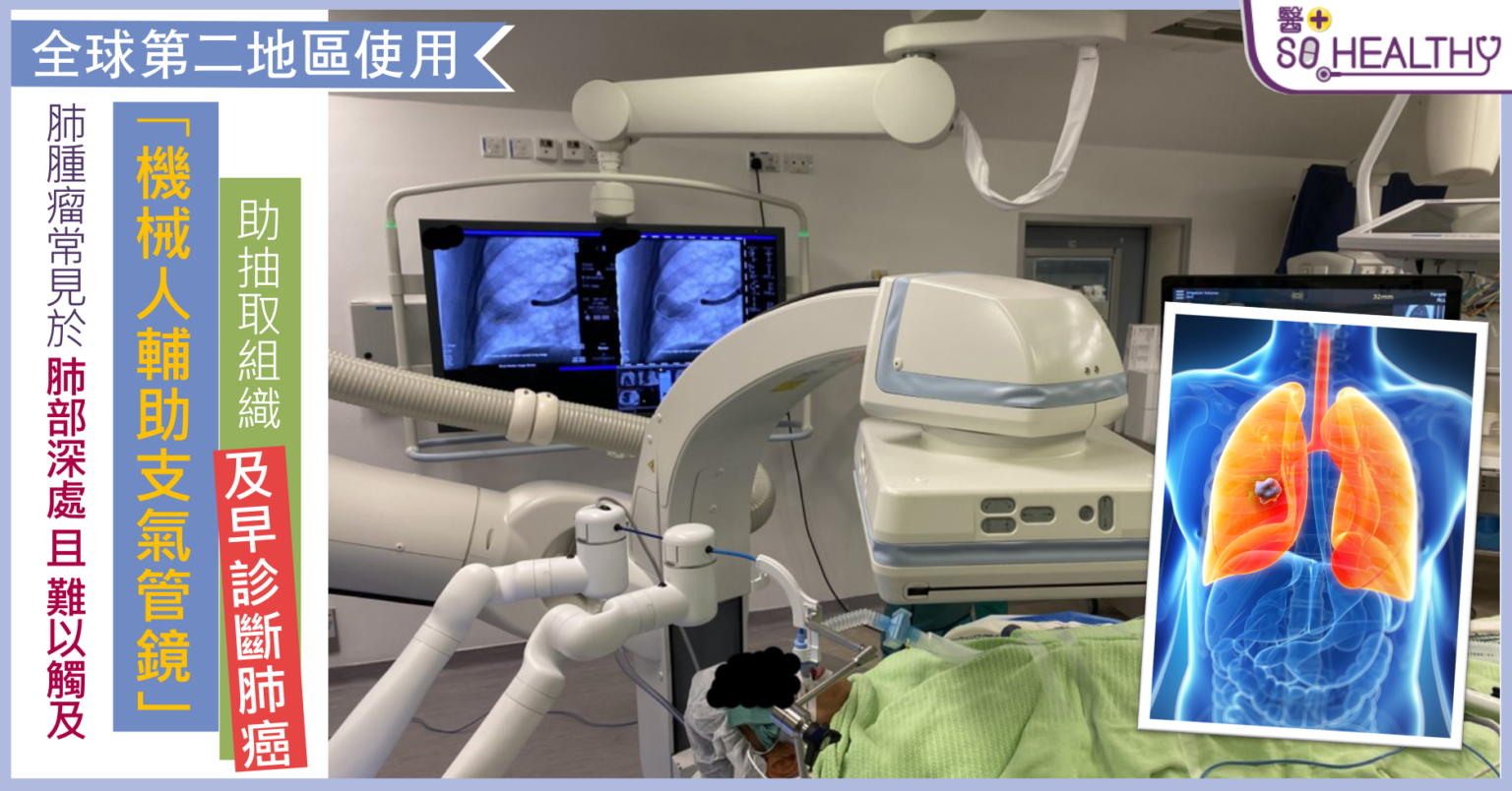 全球第2 肺腫瘤常見於肺部深處且難以觸及 「機械人輔助支氣管鏡」助抽取組織及早診斷肺癌