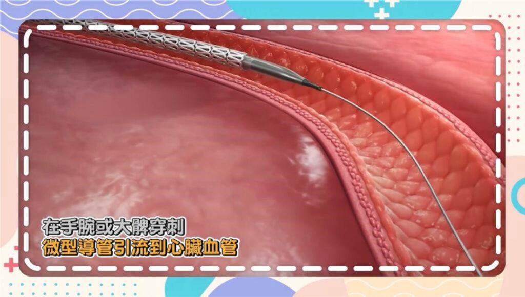 有心臟問題靠醫學秘笈？有請翁思宇醫生為Ben sir 解開5件「心事」！