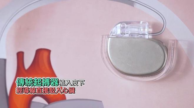 「中‧醫對決」Ben Sir挑戰醫生心臟常識？！