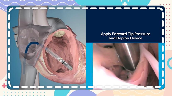 「中‧醫對決」Ben Sir挑戰醫生心臟常識？！