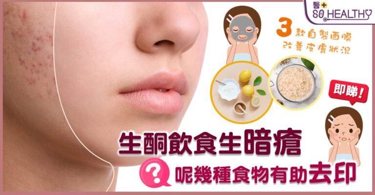 生酮飲食生暗瘡