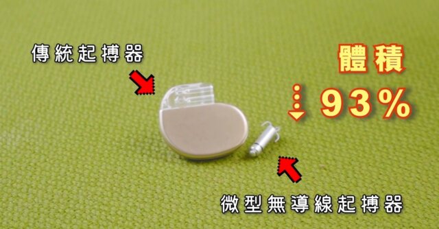 微型起搏器的體積比傳統起搏器小93%