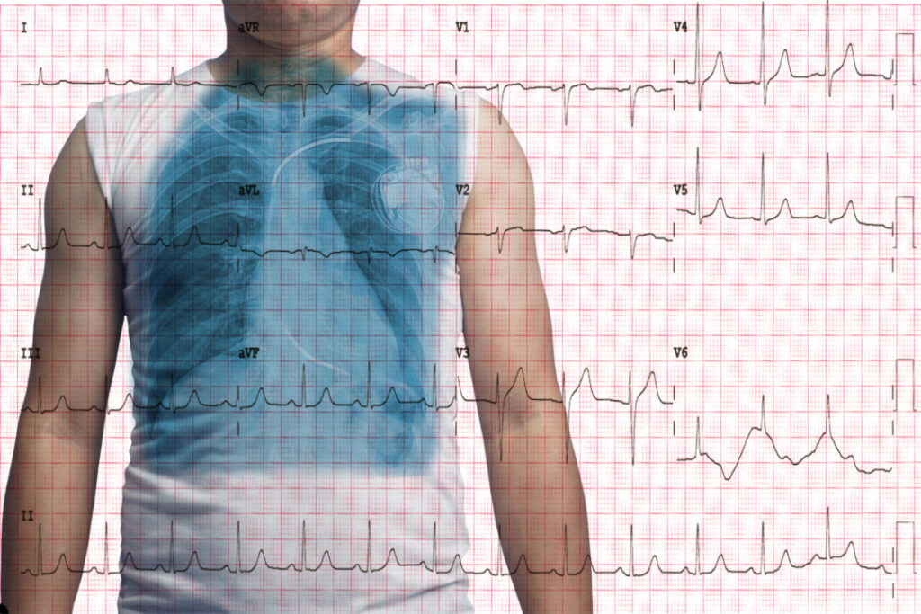 心跳快到頭暈暈?! 正視心跳過快減猝死風險
