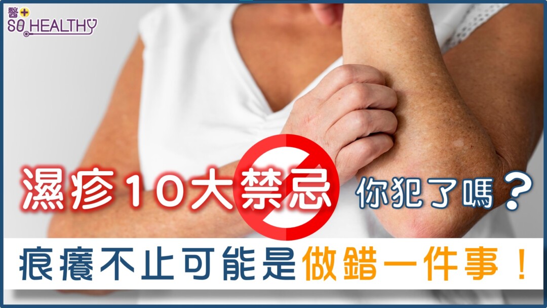 又到轉天氣的時候，有濕疹的你是否痕癢難耐？想減輕濕疹症狀，除了看皮膚科醫生、使用醫生處方的藥物，其實還能從生活入手：養成幾項簡單習慣，痕癢症狀即可減少！以下10個「不」，你又中了幾項？