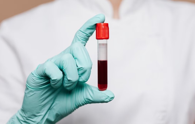 6個表徵及早發現重症肌無力症! 眼皮下垂唔係衰老咁簡單!